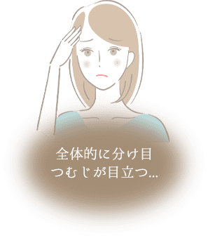 全体的に分け目つむじが目立つ...